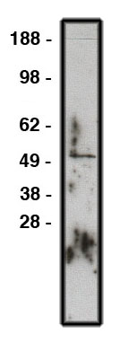 "
Western blot using GLI1 antibody (Cat. No.X2366P) on RMS-13 lysate.  Lysate used at 15µg/lane.  Antibody used at 10µg/ml.  Secondary antibody, mouse anti-rabbit HRP (Cat. No. X1207M), used at 1:200k dilution."